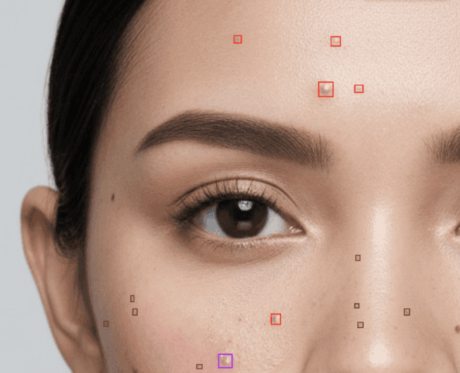 SkinDX face analysis